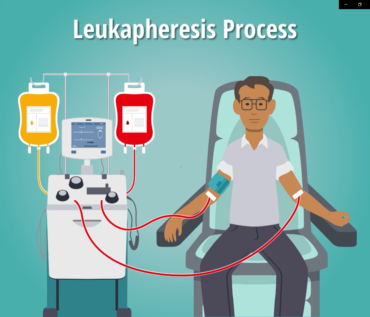 Leuk Process Brochure