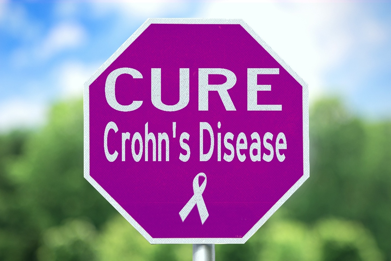 DS_Crohns_shutterstock_534811327-1-1