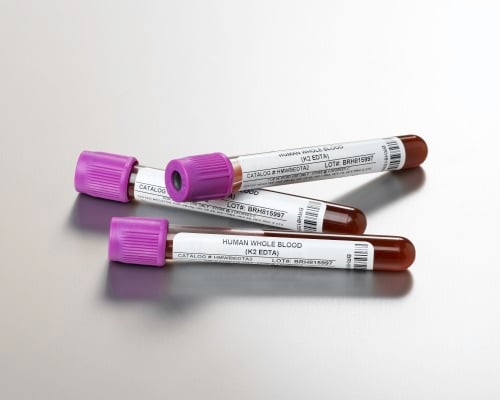 Whole Blood