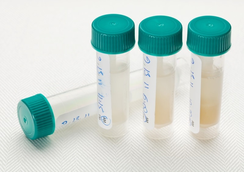 Other Biofluids
