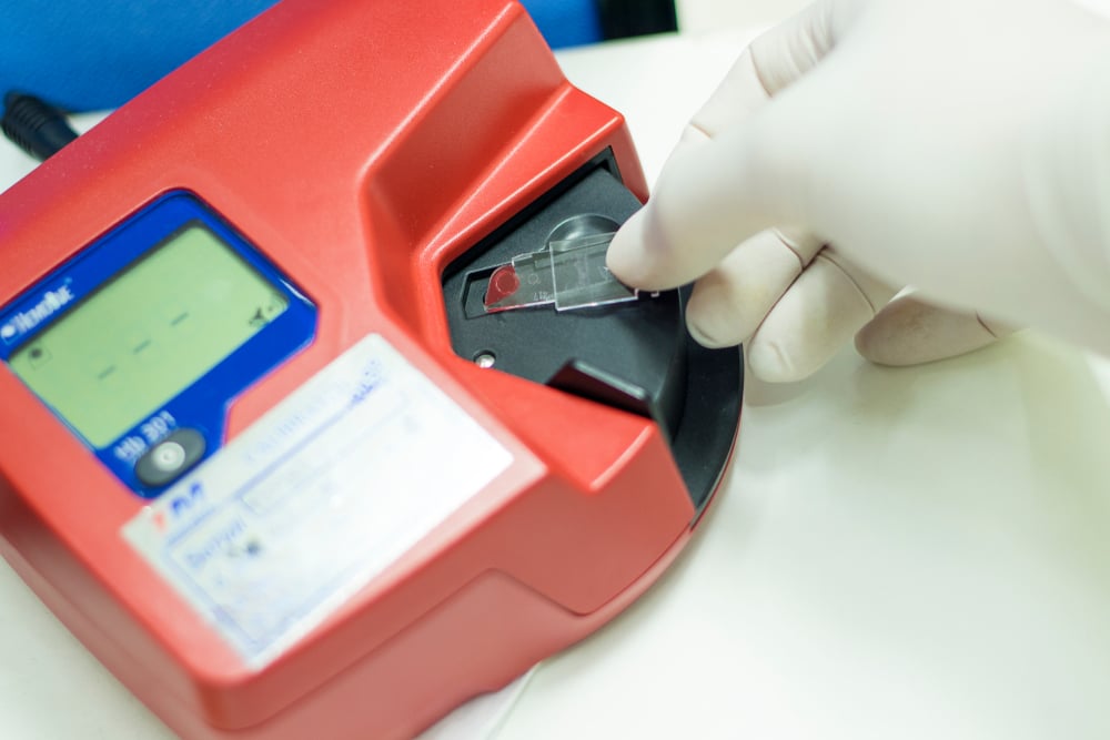shutterstock_1115722628-POC Hemoglogin